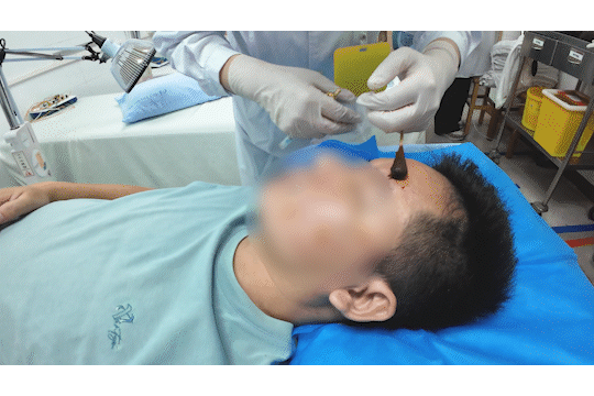 皇冠信用網代理出租_醒来“天塌了”皇冠信用網代理出租！深圳一女子眼睛闭不上、嘴巴漏水！这些错误很多人会犯