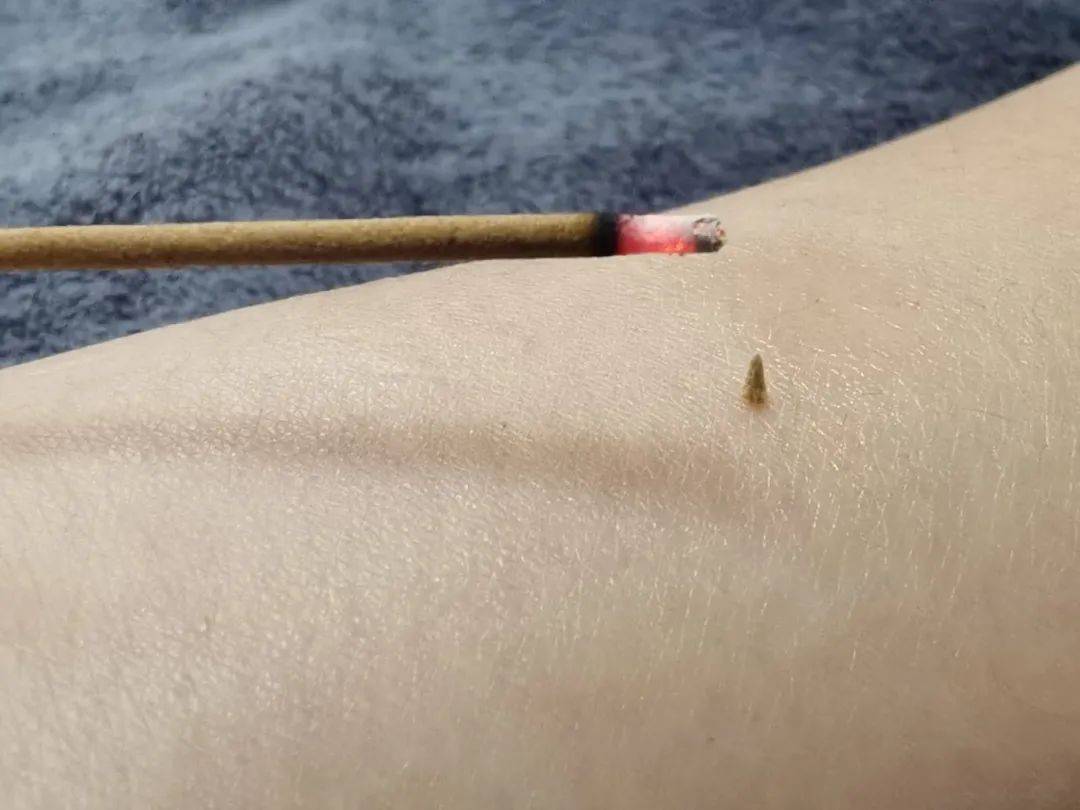 皇冠信用網代理出租_醒来“天塌了”皇冠信用網代理出租！深圳一女子眼睛闭不上、嘴巴漏水！这些错误很多人会犯