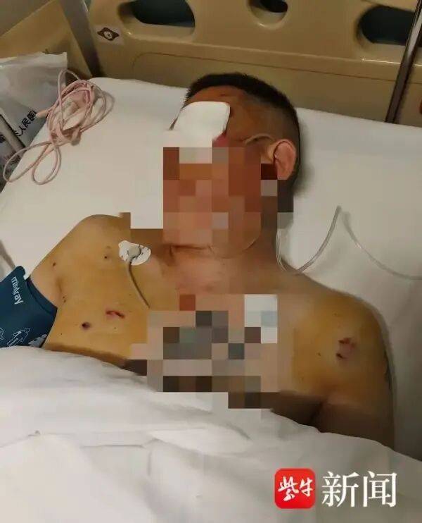 丹佛掘金 vs 达拉斯独行侠_男子取170万元现金银行门口遭抢丹佛掘金 vs 达拉斯独行侠，工作人员无动于衷